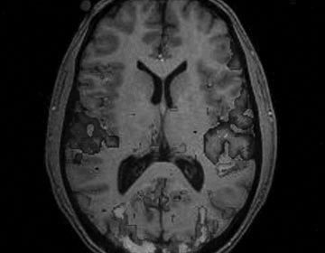 Cornell researchers used fMRIs to observe brain activity. (Image Source: scientopia.org)